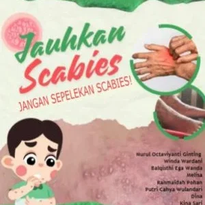 JAUHKAN SCABIES : Jangan Sepelekan Scabies!